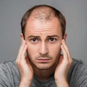 Гормональные нарушения как фактор выпадения волос: методы диагностики и коррекции