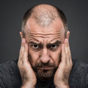 Мужское облысение (андрогенетическая алопеция): причины, признаки и современные методы лечения