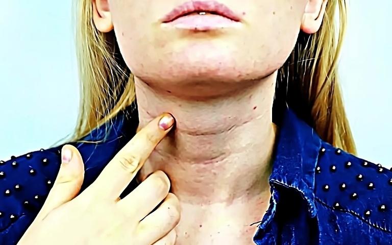 Женщина указывает на область шеи при проблемах с щитовидной железой